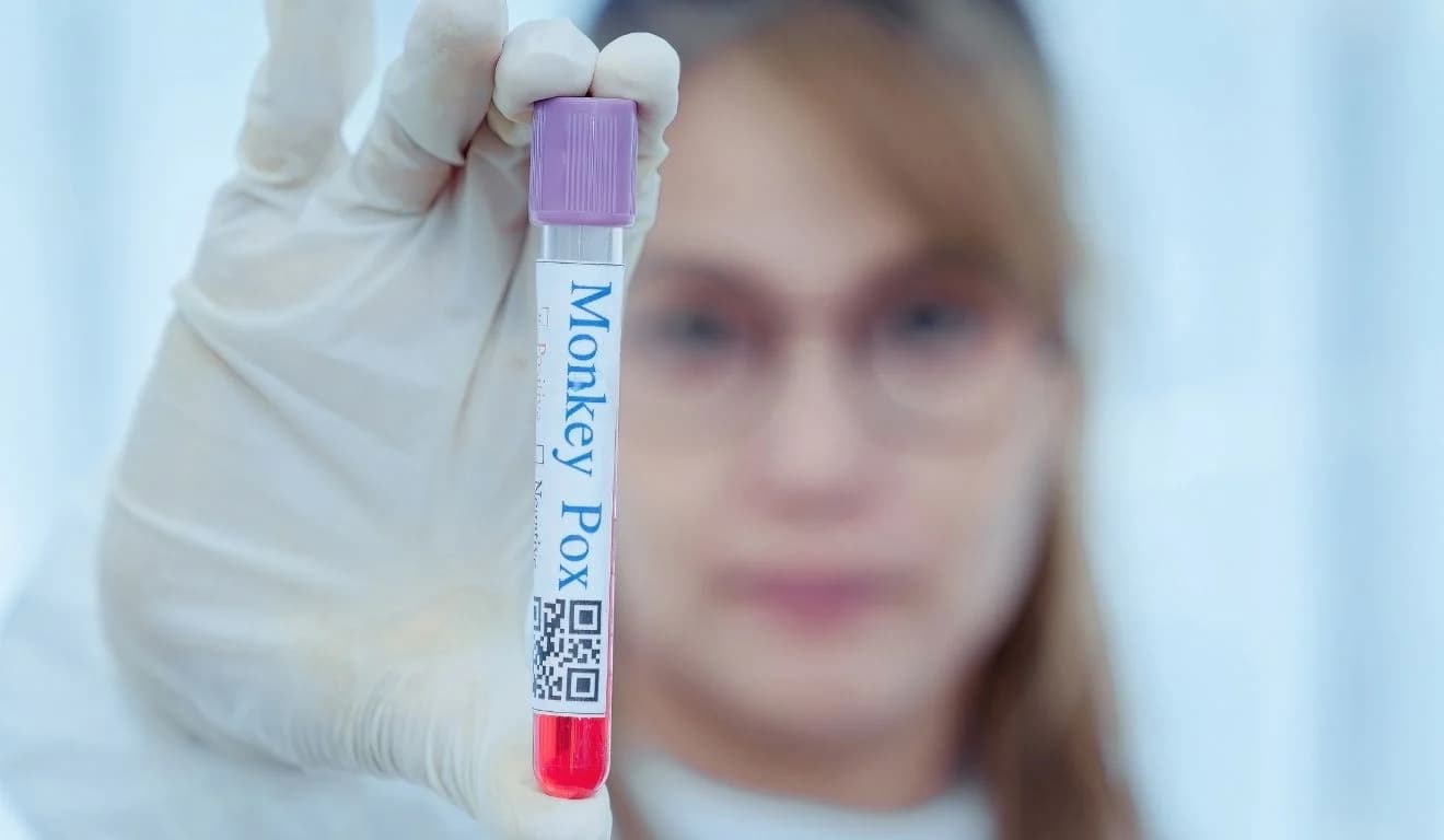 Espírito Santo registra terceiro caso de mpox e dois seguem em investigação