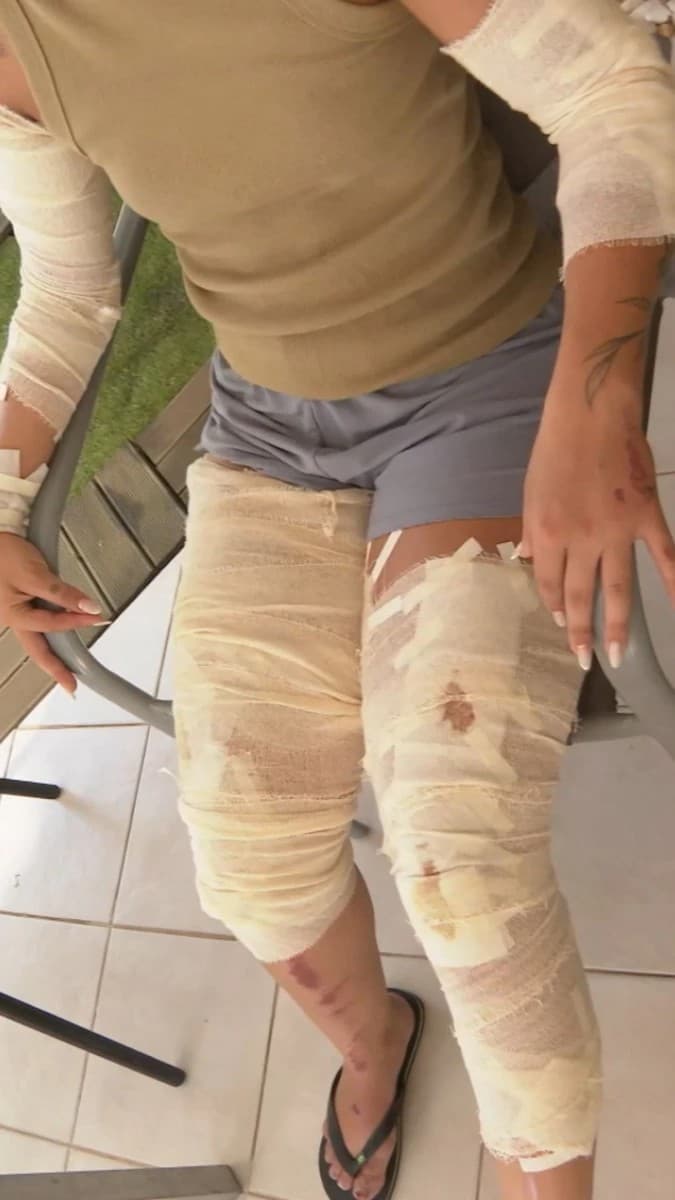 Violência em Carnaval: Ex-marido atropela contadora em Manguinhos