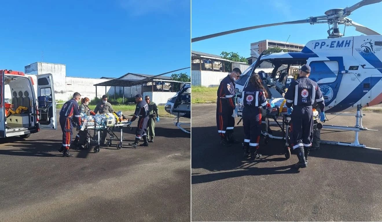 Tragédia em Guarapari: Mulher Sofre Queimaduras Graves ao Acender Churrasqueira